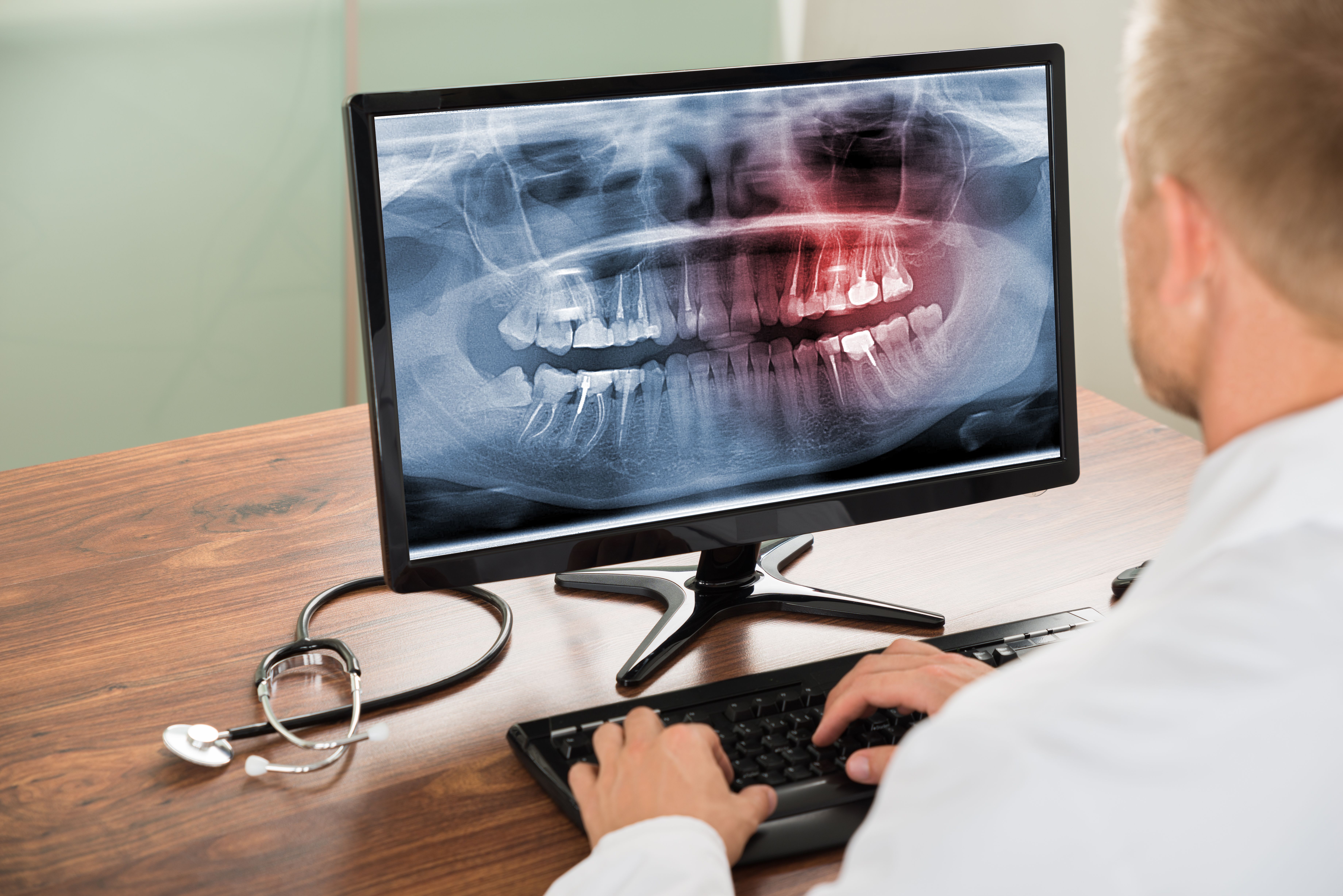 Dentist looking at digital x-ray of mouth on desktop
